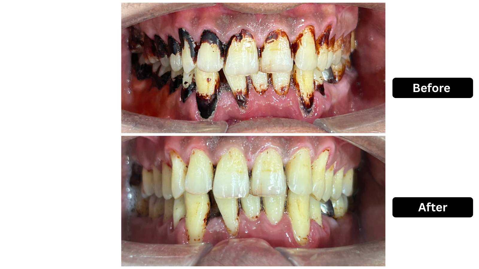Dental Equipment