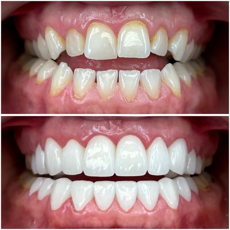 Smile Designing and Cosmetic Dentistry Vasai